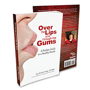 Over the Lips and Through the Gums Book by Cindy Haas